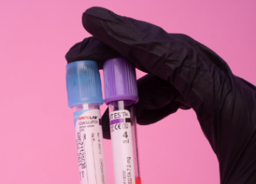 Disease Biomarkers and Diagnosis at GSA Muni Labs