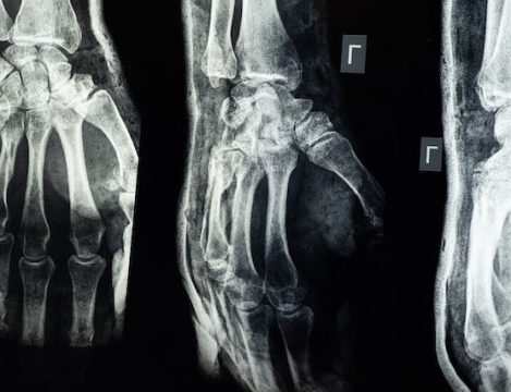 Medical imaging at Muni Labs GSA