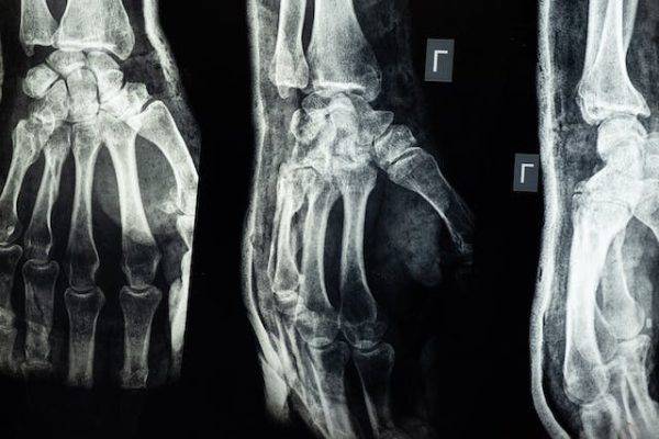 Medical imaging at Muni Labs GSA